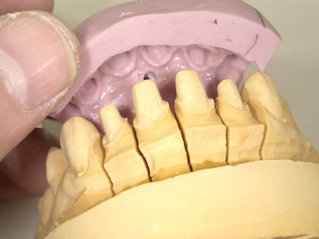 歯ぐきの再現